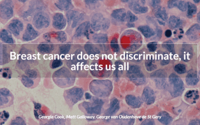 Breast cancer does not discriminate, it affects us all