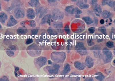 Breast cancer does not discriminate, it affects us all