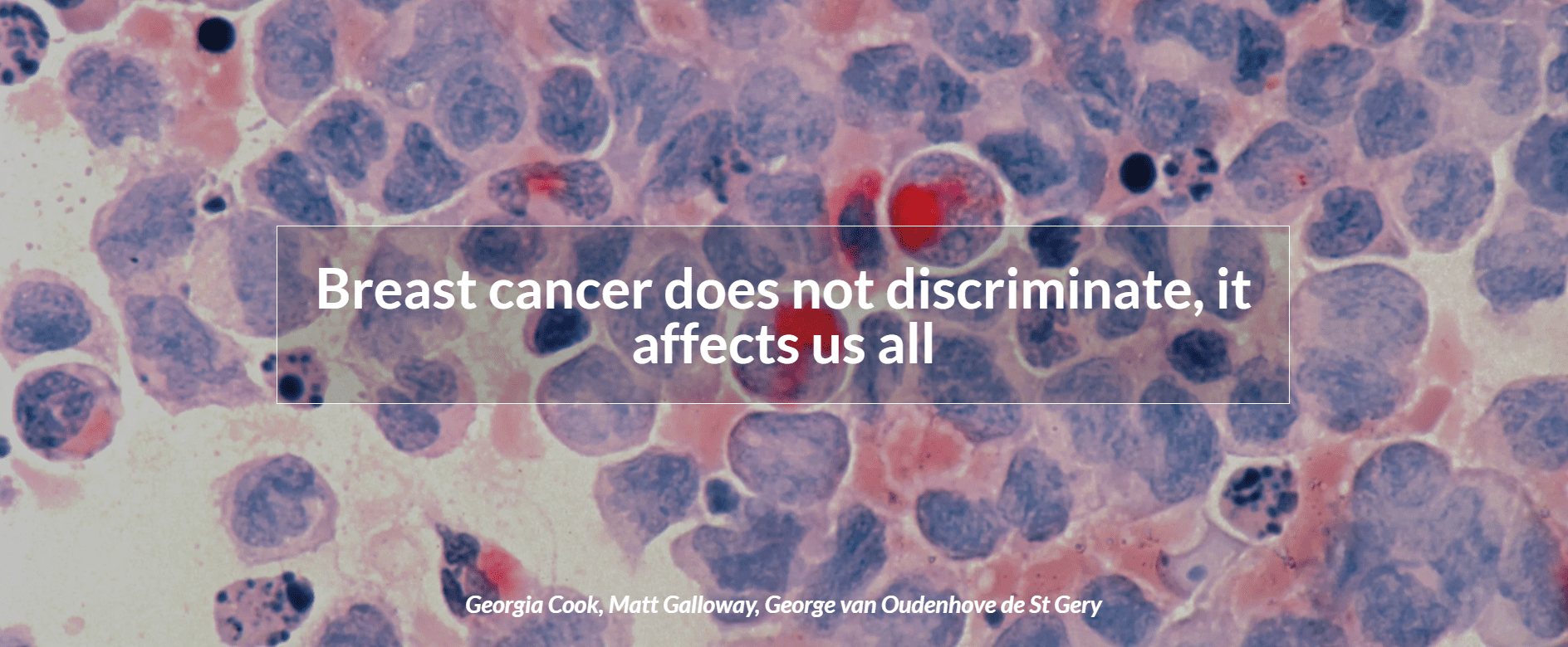 Breast cancer does not discriminate, it affects us all