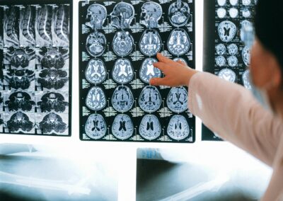 “Ultra-Fast” MRI could transform dementia diagnosis in Yorkshire