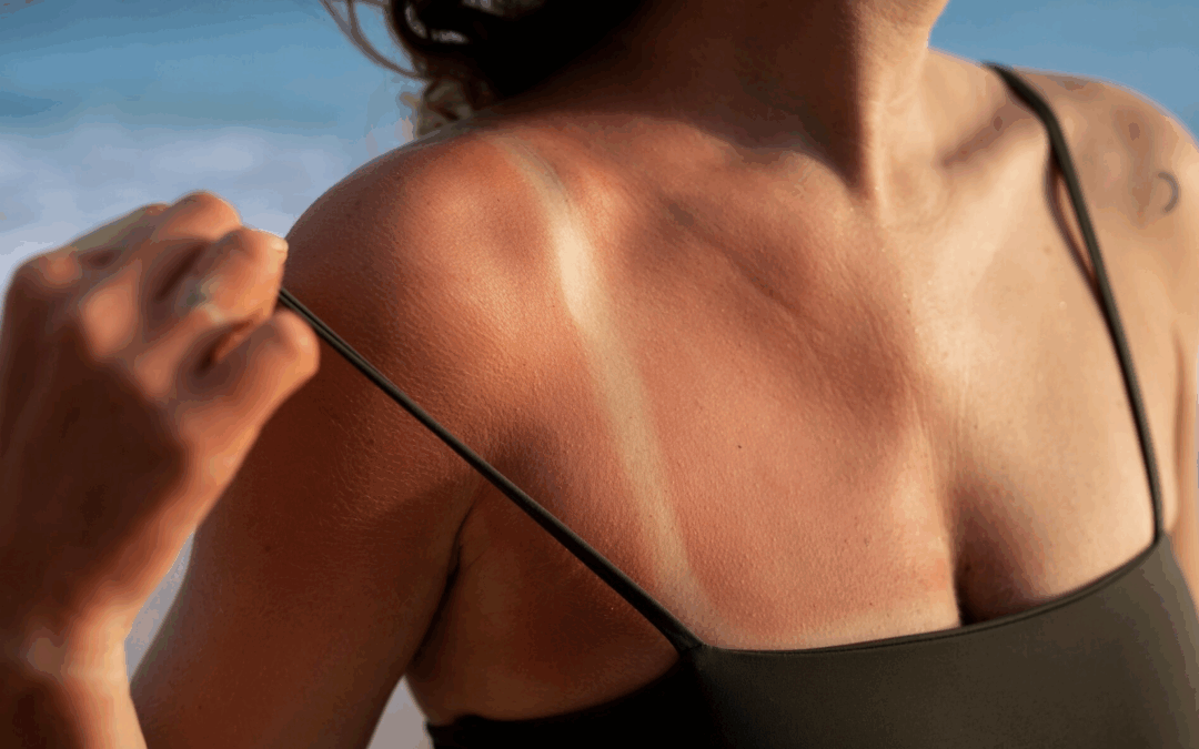 Chasing the glow, why are we so obsessed with tanning?