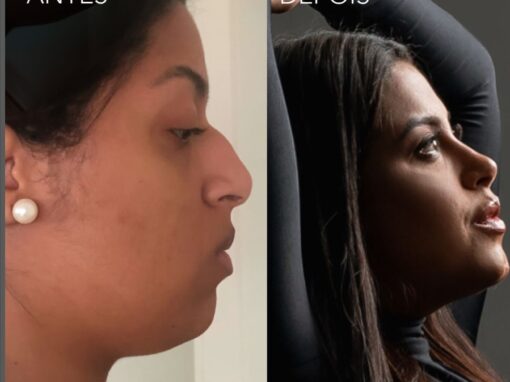 Brazil’s plastic surgery culture
