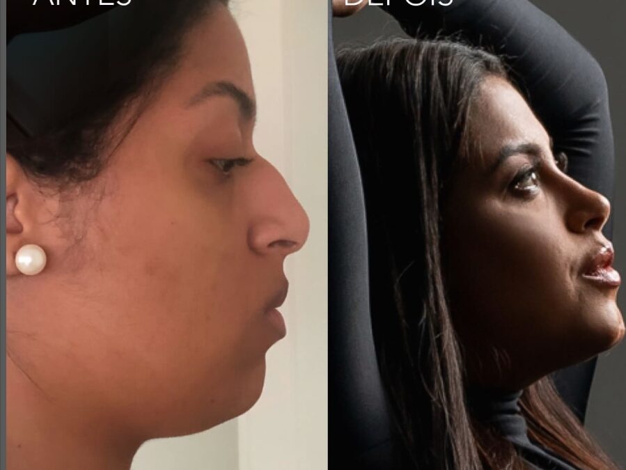 Brazil’s plastic surgery culture