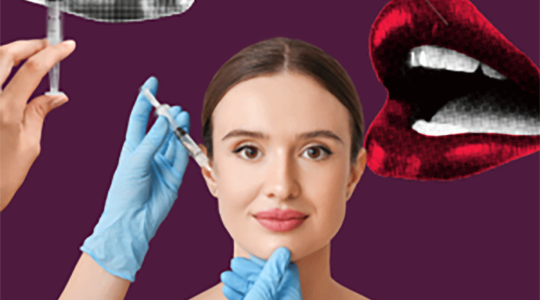 I want fillers… so now what?