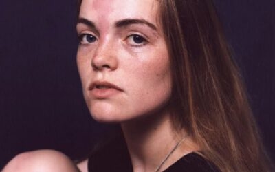 Leaving Our Mark: normalising the beauty in our differences