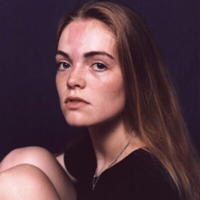 Leaving Our Mark: normalising the beauty in our differences