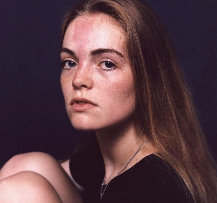 Leaving Our Mark: normalising the beauty in our differences