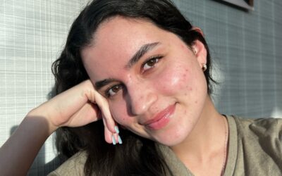 Let’s Talk About Acne, a Teenage Nightmare.