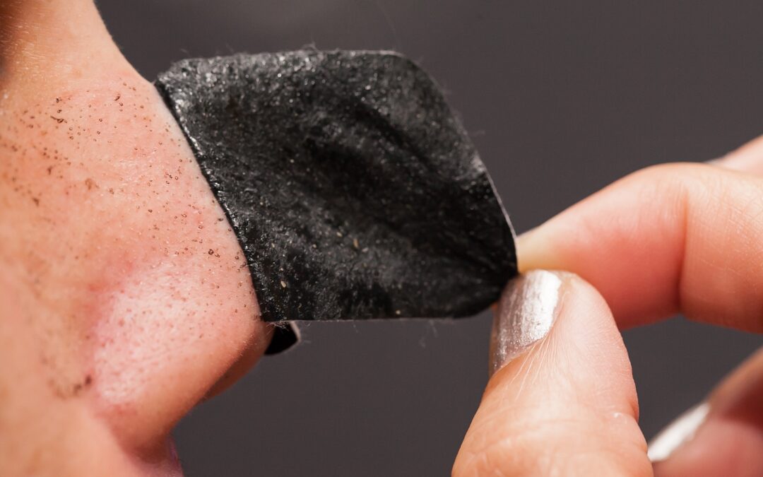 Blackhead: Strawberry Nose? Go Away!