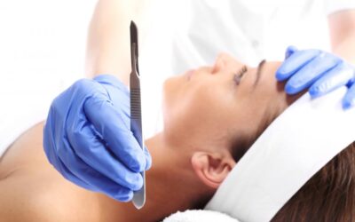 Is the peach fuzz really worth putting a blade to it? Dermaplaning explained