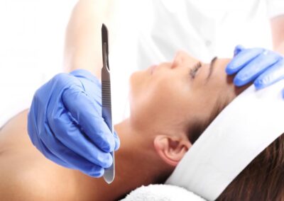 Is the peach fuzz really worth putting a blade to it? Dermaplaning explained