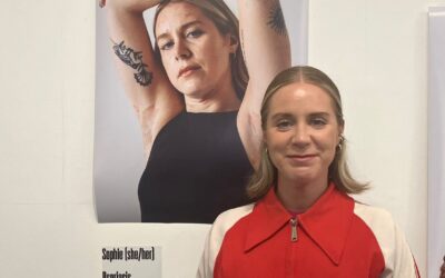 Flare ups? Flaky skin? We don’t mind – #GetYourSkinOut