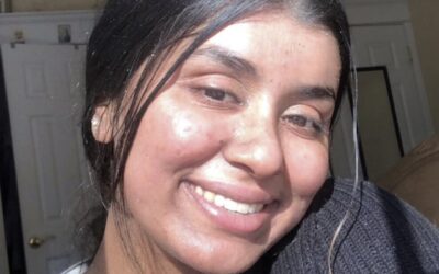 ‘My rare skin condition helped me find purpose’: Eileen’s Ichthyosis Story