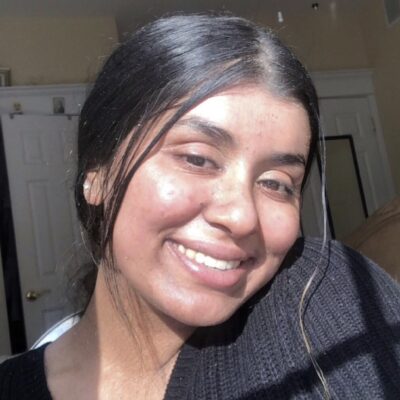 ‘My rare skin condition helped me find purpose’: Eileen’s Ichthyosis Story