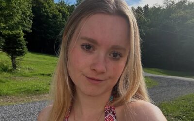 ‘It is a part of who I am, but I am so much more than that’: India’s psoriasis story