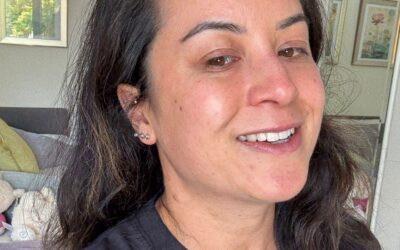Katherine’s story: Living with Neurofibromatosis (NF1)