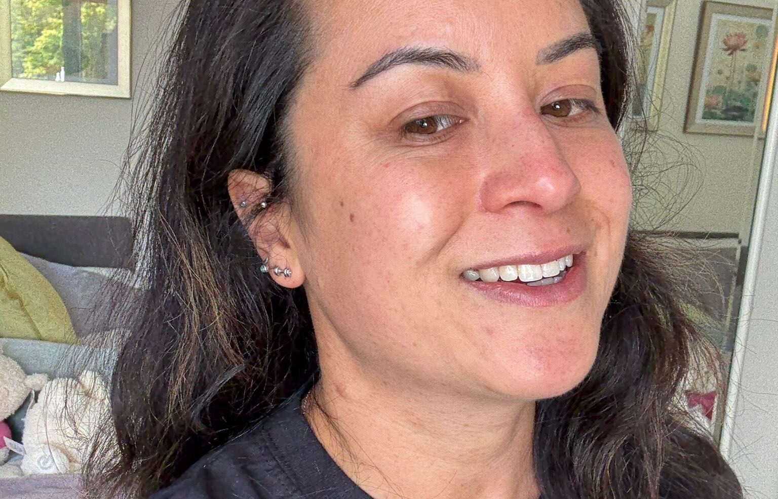 Katherine’s story: Living with Neurofibromatosis (NF1)