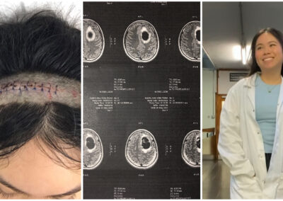 19-year-old brain tumour survivor, is now a medical student and influencer with thousands of followers